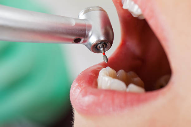 Best Emergency Broken Tooth Repair in Horizon West, FL